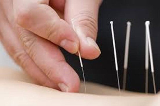 Foto 1 - Clnica popular de acupuntura- terapias e esttica